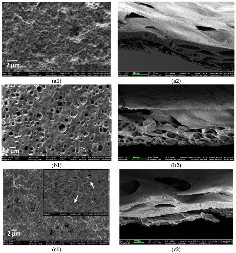 https://cdn.ncbi.nlm.nih.gov/pmc/blobs/3f3a/5618120/24a931da16c7/membranes-07-00035-g005a.jpg