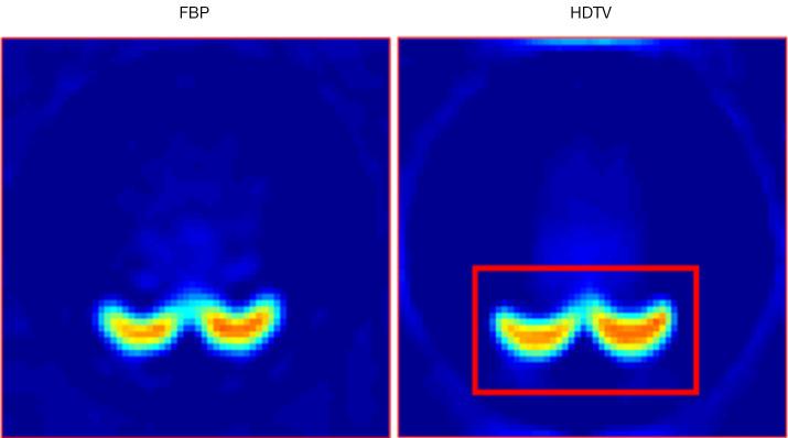 https://cdn.ncbi.nlm.nih.gov/pmc/blobs/3f3b/12397748/a0c668a289fa/qims-15-09-8471-f6.jpg
