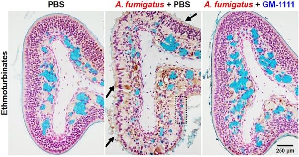 https://cdn.ncbi.nlm.nih.gov/pmc/blobs/3f49/6155557/cf7362ba562b/pone.0204709.g005.jpg
