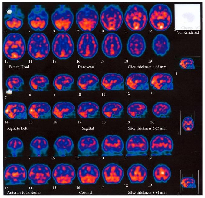 https://cdn.ncbi.nlm.nih.gov/pmc/blobs/3f4a/4835631/68cd8bd7599e/CRIM2016-9183979.001.jpg