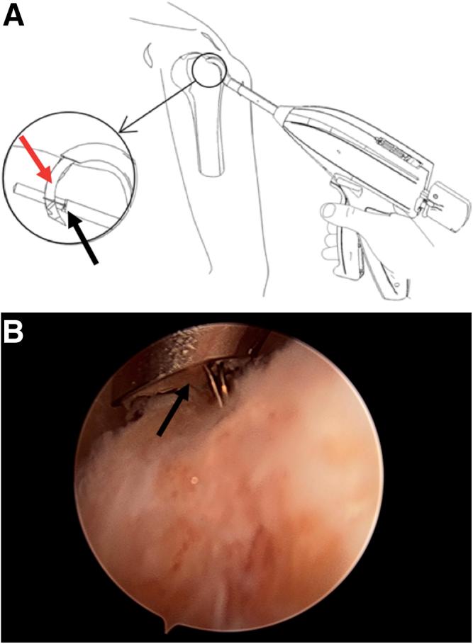 https://cdn.ncbi.nlm.nih.gov/pmc/blobs/3f4a/6993199/b941f21f5b48/gr5.jpg