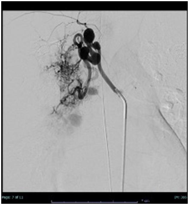 https://cdn.ncbi.nlm.nih.gov/pmc/blobs/3f4b/11850261/24f771b27661/fmed-12-1490820-g0003.jpg