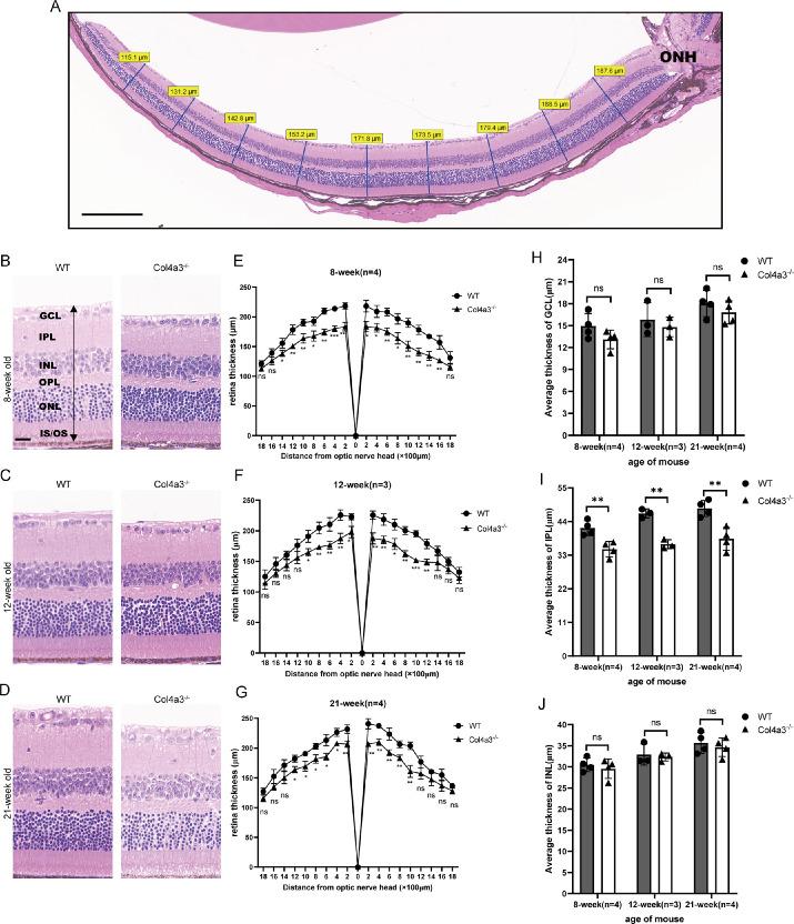 https://cdn.ncbi.nlm.nih.gov/pmc/blobs/3f4f/11268448/ec11aaa4a5e9/tvst-13-7-16-f006.jpg