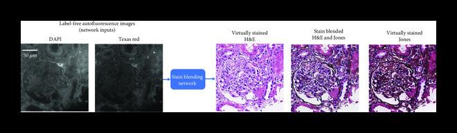 https://cdn.ncbi.nlm.nih.gov/pmc/blobs/3f51/10521663/917a5752599b/9647163.fig.004b.jpg