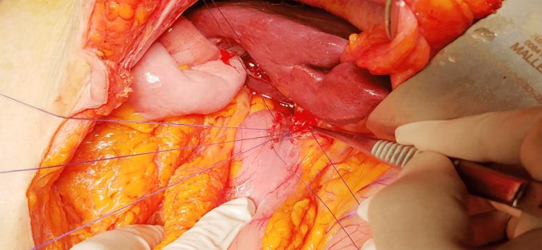 https://cdn.ncbi.nlm.nih.gov/pmc/blobs/3f53/12223757/0011b484e89b/PJMS-41-1579-g002.jpg