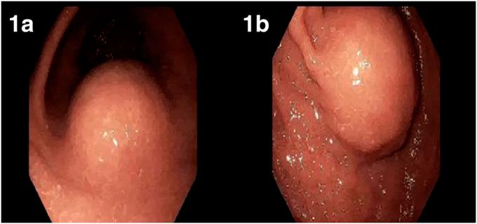 https://cdn.ncbi.nlm.nih.gov/pmc/blobs/3f56/9246068/89de6ec51fb7/ac9-9-e00767-g001.jpg