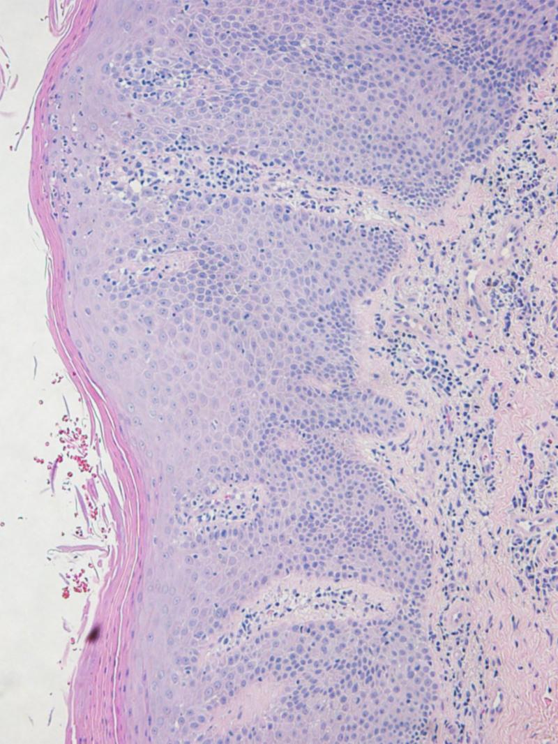 https://cdn.ncbi.nlm.nih.gov/pmc/blobs/3f5a/12245232/1ea4c61f581b/jw9-11-e216-g002.jpg