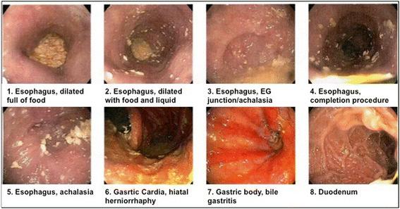 https://cdn.ncbi.nlm.nih.gov/pmc/blobs/3f5a/4936023/dacf0b7fcaa9/13019_2016_495_Fig1_HTML.jpg