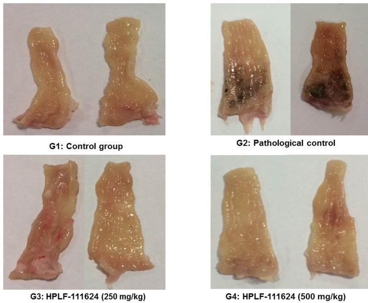 https://cdn.ncbi.nlm.nih.gov/pmc/blobs/3f5b/9058020/3564c8c5bf5a/JEP-14-149-g0008.jpg