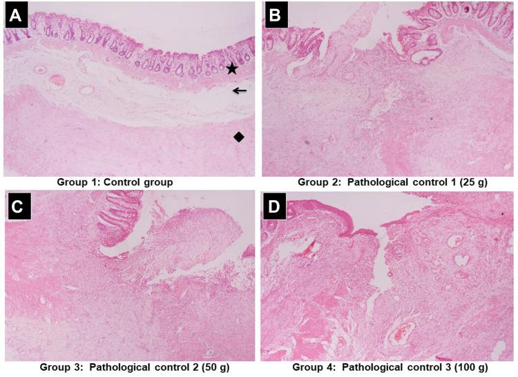https://cdn.ncbi.nlm.nih.gov/pmc/blobs/3f5b/9058020/ba38a0c9cd58/JEP-14-149-g0006.jpg