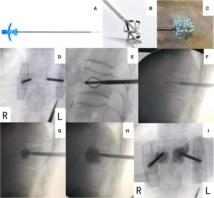 https://cdn.ncbi.nlm.nih.gov/pmc/blobs/3f63/10811784/2fe7c8311a96/fonc-13-1312491-g001.jpg