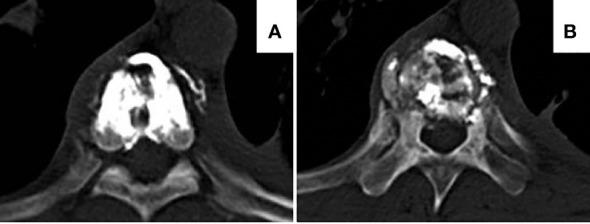 https://cdn.ncbi.nlm.nih.gov/pmc/blobs/3f63/10811784/e88ad57021a2/fonc-13-1312491-g002.jpg