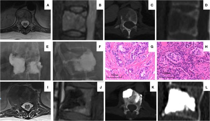 https://cdn.ncbi.nlm.nih.gov/pmc/blobs/3f63/10811784/f748a03898b0/fonc-13-1312491-g003.jpg