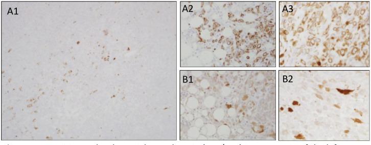 https://cdn.ncbi.nlm.nih.gov/pmc/blobs/3f65/5985749/ef51e60f0110/can-12-832fig3.jpg