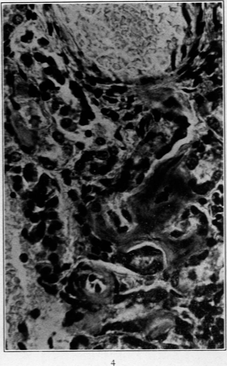 https://cdn.ncbi.nlm.nih.gov/pmc/blobs/3f6b/2007301/c156ab09f731/amjpathol00612-0156-b.jpg