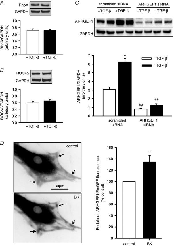 https://cdn.ncbi.nlm.nih.gov/pmc/blobs/3f73/5746525/035ff7d2ab9f/TJP-596-47-g003.jpg