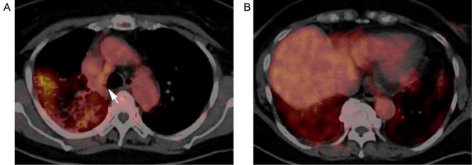 https://cdn.ncbi.nlm.nih.gov/pmc/blobs/3f77/11239263/2be3d086fc4a/1349-7235-63-1789-g003.jpg