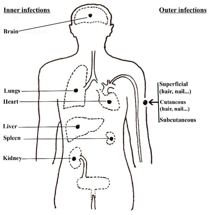 https://cdn.ncbi.nlm.nih.gov/pmc/blobs/3f7c/11124197/c9dee229d6f0/pathogens-13-00426-g003.jpg