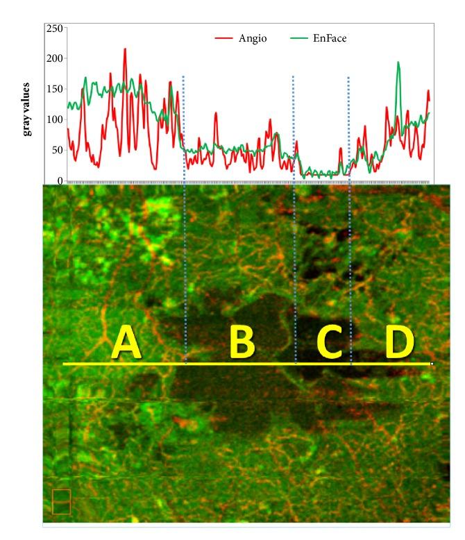 https://cdn.ncbi.nlm.nih.gov/pmc/blobs/3f82/6446091/0d73f48743d6/BMRI2019-7835372.003.jpg
