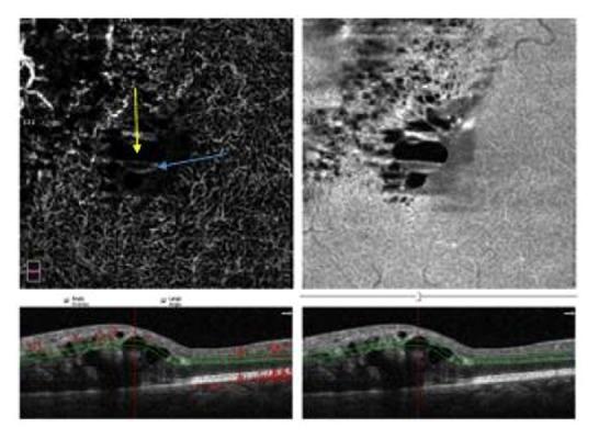 https://cdn.ncbi.nlm.nih.gov/pmc/blobs/3f82/6446091/cd47545e9467/BMRI2019-7835372.005.jpg