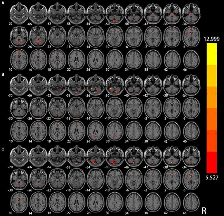 https://cdn.ncbi.nlm.nih.gov/pmc/blobs/3f86/11007178/c7f642a3af3c/fnagi-16-1375836-g001.jpg
