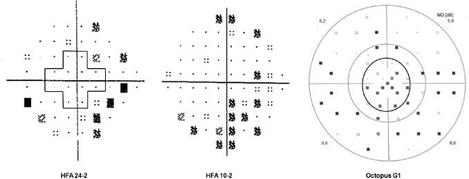 https://cdn.ncbi.nlm.nih.gov/pmc/blobs/3f8f/5659771/4267adc689c9/pone.0186793.g001.jpg