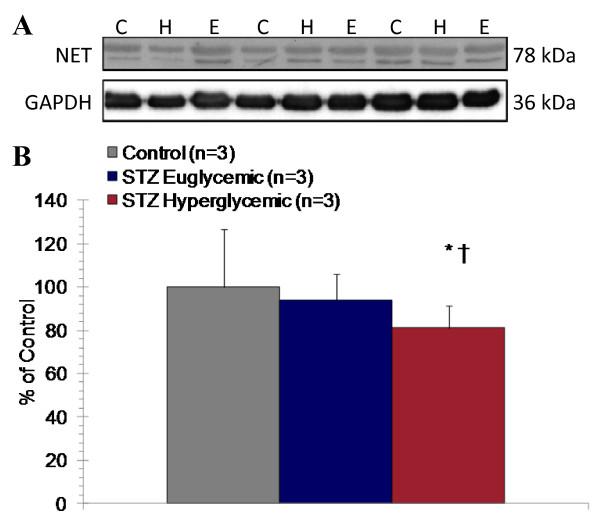 https://cdn.ncbi.nlm.nih.gov/pmc/blobs/3f90/3170183/0d29f893a806/1475-2840-10-75-7.jpg