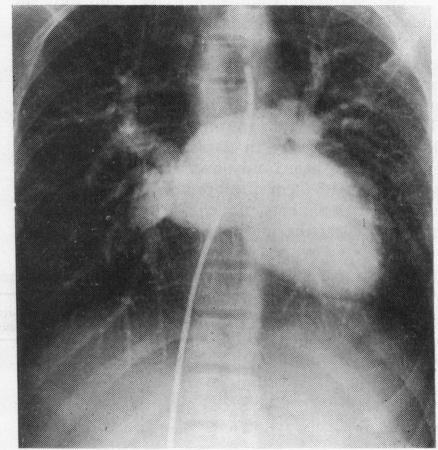 https://cdn.ncbi.nlm.nih.gov/pmc/blobs/3f98/483289/f06ad7c9b3da/brheartj00232-0036-a.jpg