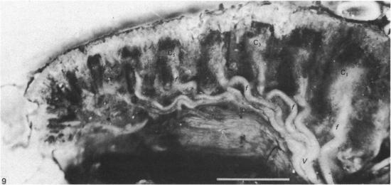 https://cdn.ncbi.nlm.nih.gov/pmc/blobs/3fa5/1166371/5180796becab/janat00191-0183-d.jpg
