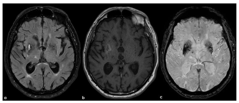 https://cdn.ncbi.nlm.nih.gov/pmc/blobs/3fa9/11855991/52552e499c61/life-15-00180-g005.jpg