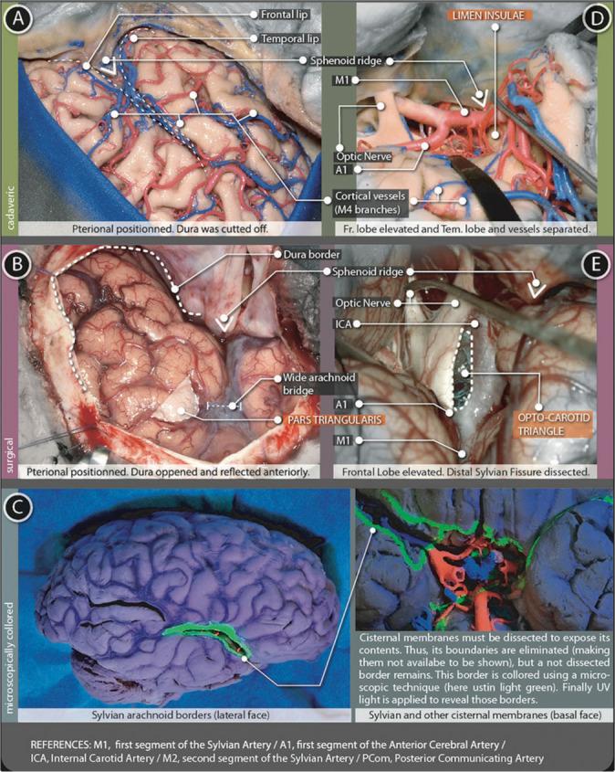 https://cdn.ncbi.nlm.nih.gov/pmc/blobs/3fab/10070334/477de776147a/SNI-14-97-g004.jpg