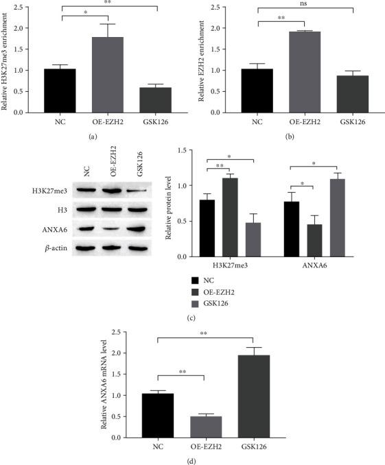 https://cdn.ncbi.nlm.nih.gov/pmc/blobs/3fae/9492406/00d3f607a58b/OMCL2022-4838760.005.jpg