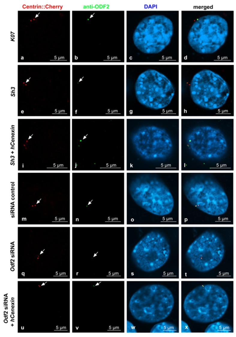 https://cdn.ncbi.nlm.nih.gov/pmc/blobs/3fb7/10486571/8b9a9e733435/cells-12-02194-g005.jpg