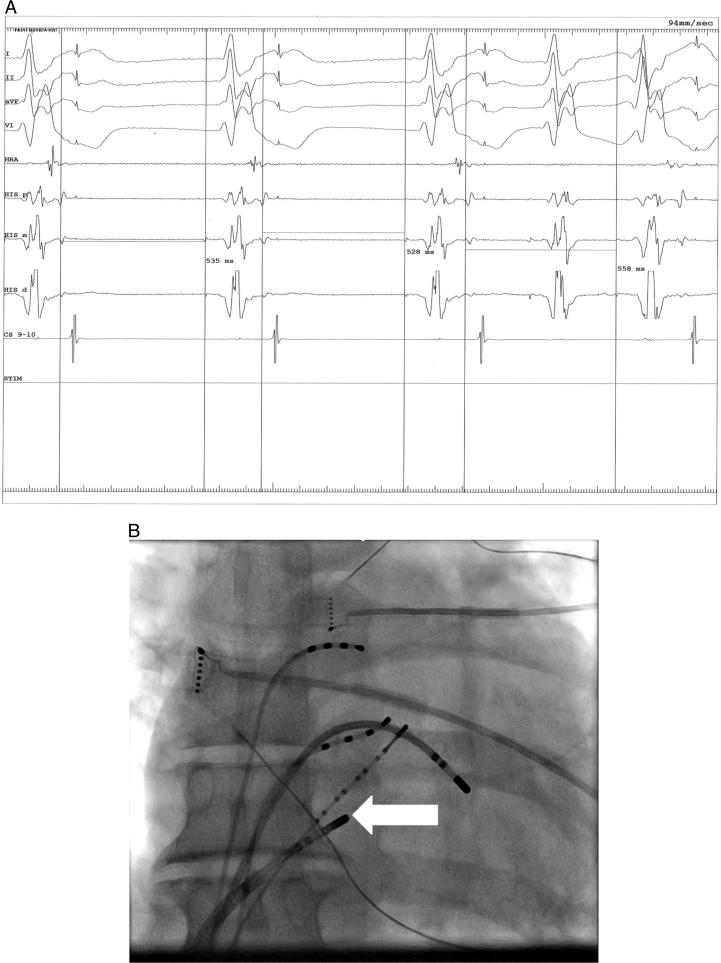 https://cdn.ncbi.nlm.nih.gov/pmc/blobs/3fb9/5420030/027cb2a67e1d/gr3.jpg