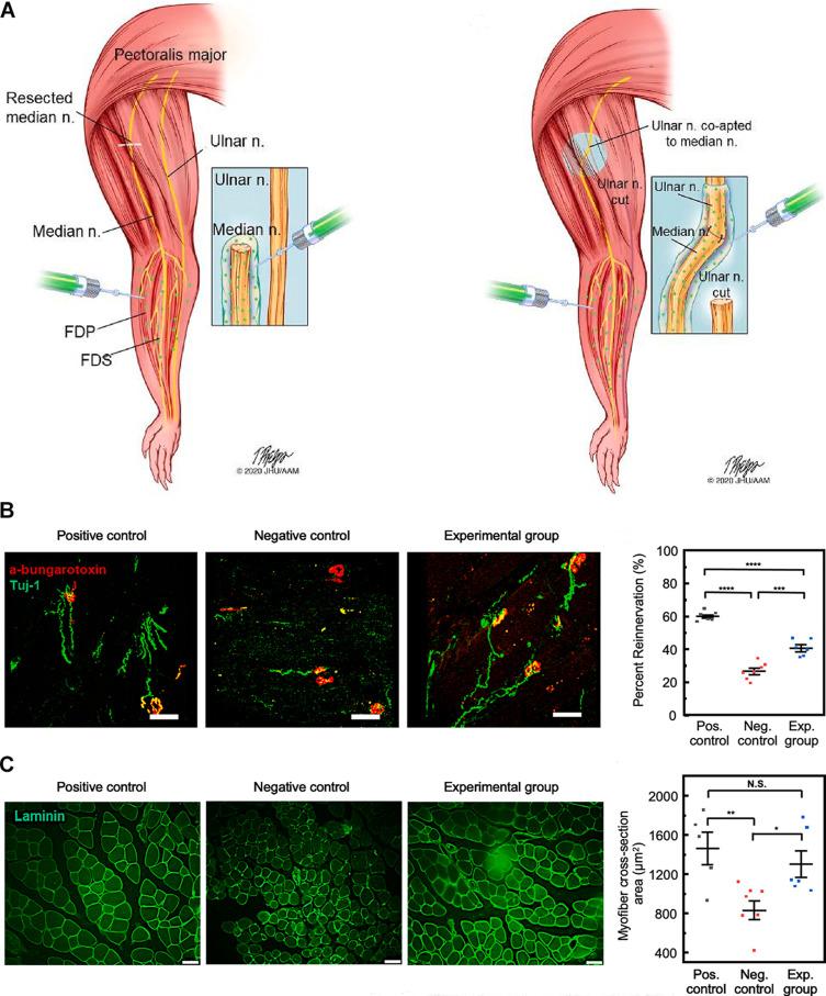 https://cdn.ncbi.nlm.nih.gov/pmc/blobs/3fcc/10771795/f78cfe0b5ef0/IJN-19-19-g0004.jpg