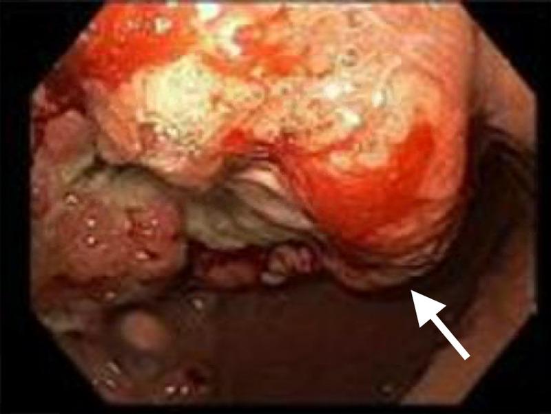 https://cdn.ncbi.nlm.nih.gov/pmc/blobs/3fcc/7781786/1828f28ff493/cureus-0012-00000011874-i02.jpg