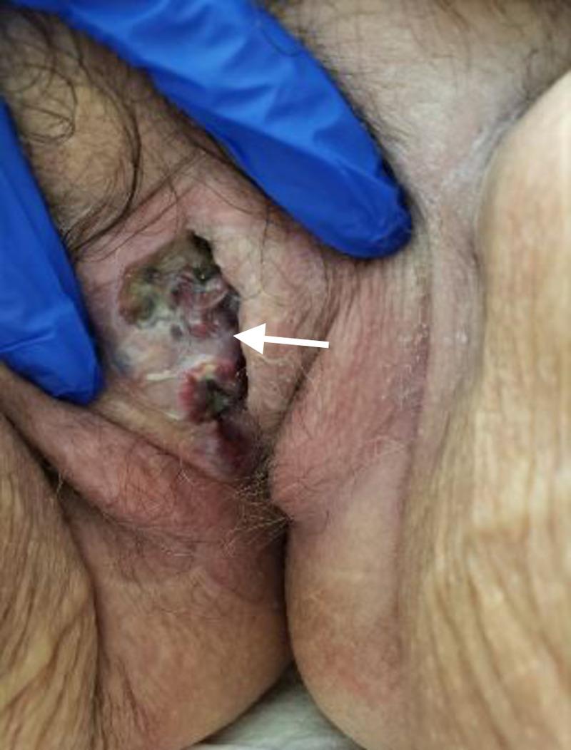 https://cdn.ncbi.nlm.nih.gov/pmc/blobs/3fcc/7781786/804e5facb0df/cureus-0012-00000011874-i05.jpg