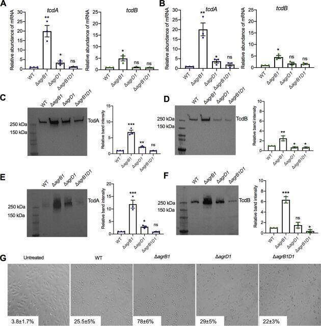 https://cdn.ncbi.nlm.nih.gov/pmc/blobs/3fce/8534292/685a89a098e4/mbio.03190-20-f0005.jpg