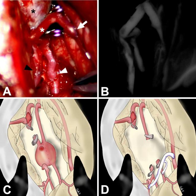 https://cdn.ncbi.nlm.nih.gov/pmc/blobs/3fd3/12087369/ec8ffd062ad2/CASE25100_figure_2.jpg