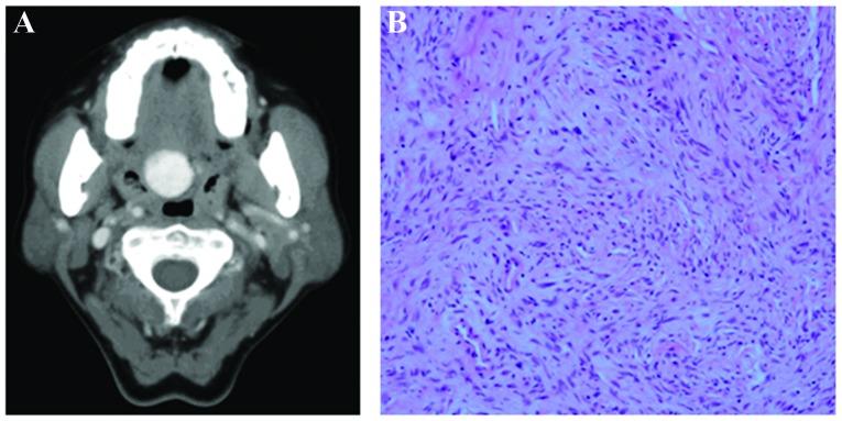 https://cdn.ncbi.nlm.nih.gov/pmc/blobs/3fd5/4049756/829372cd41d1/OL-07-06-1975-g00.jpg