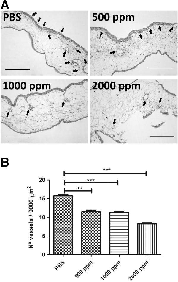https://cdn.ncbi.nlm.nih.gov/pmc/blobs/3fd9/4101715/1fcd55781f10/40659_2014_20_Fig1_HTML.jpg