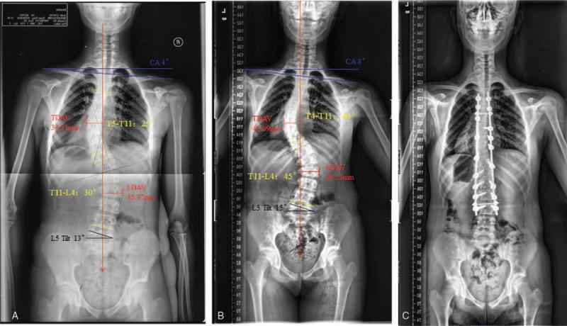 https://cdn.ncbi.nlm.nih.gov/pmc/blobs/3fd9/6392533/043277e21094/medi-96-e9425-g002.jpg