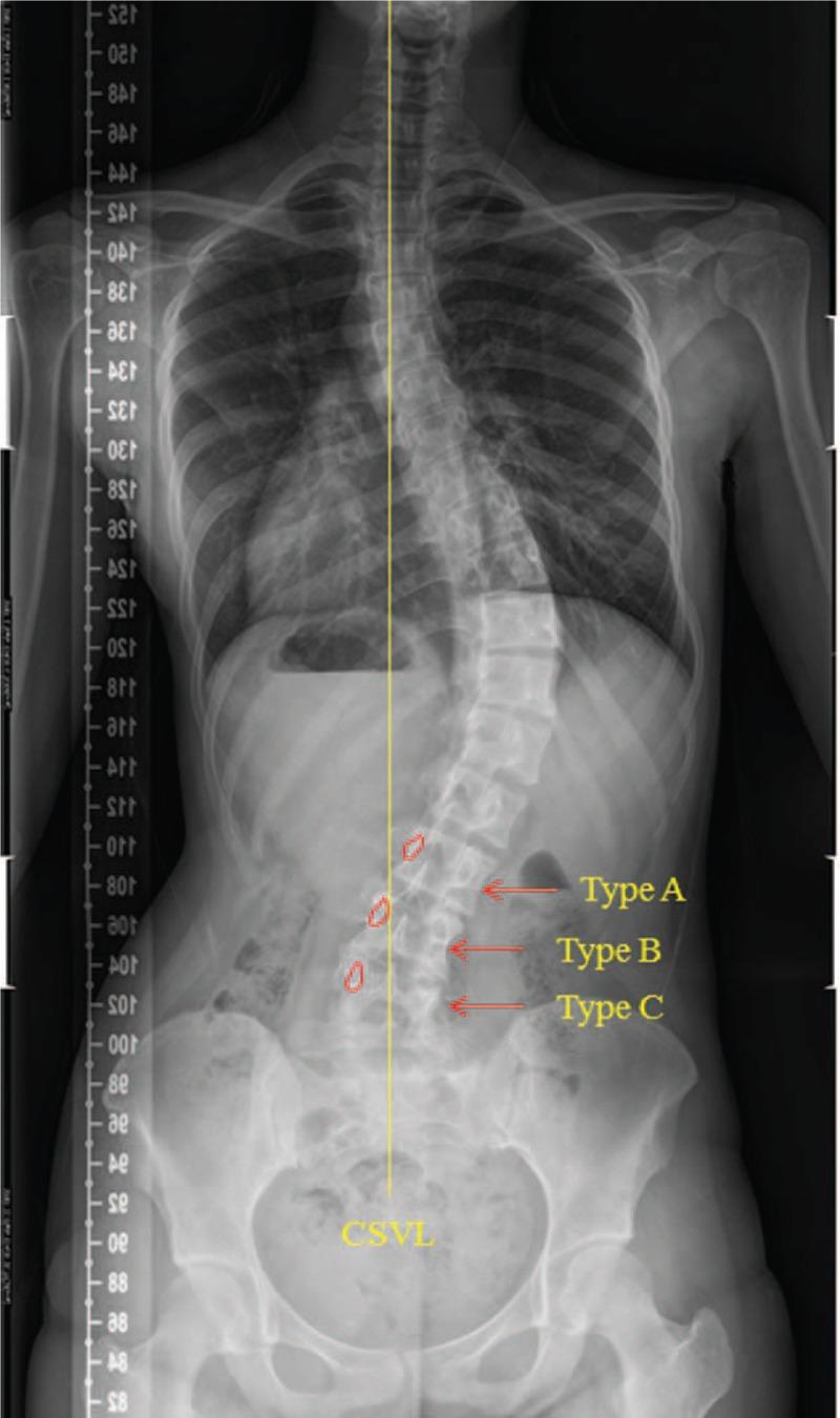 https://cdn.ncbi.nlm.nih.gov/pmc/blobs/3fd9/6392533/63c52d4d2faf/medi-96-e9425-g001.jpg