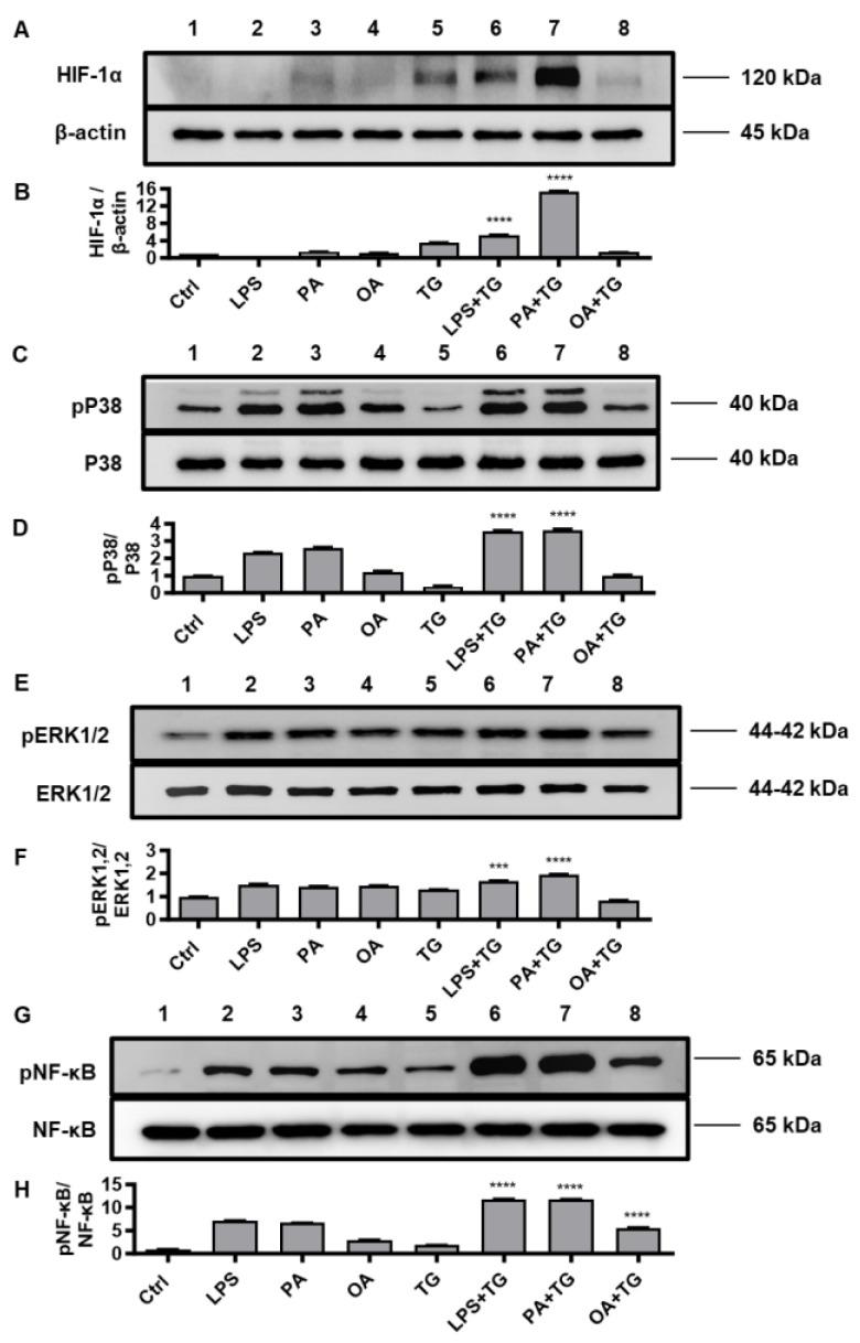 https://cdn.ncbi.nlm.nih.gov/pmc/blobs/3fda/10606873/ebb850f18fa1/ijms-24-15186-g005.jpg