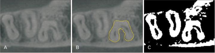 https://cdn.ncbi.nlm.nih.gov/pmc/blobs/3fdc/9256481/2074921ffaac/acb-55-2-155-f3.jpg