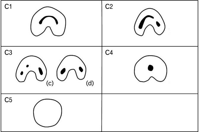 https://cdn.ncbi.nlm.nih.gov/pmc/blobs/3fdc/9256481/94d394daef14/acb-55-2-155-f4.jpg