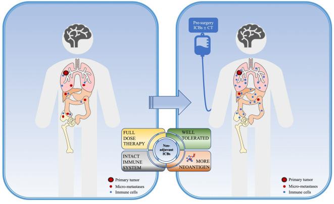 https://cdn.ncbi.nlm.nih.gov/pmc/blobs/3fde/9902866/9690a185afae/fonc-12-1099304-g001.jpg