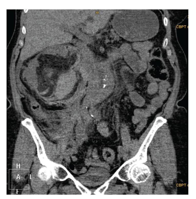https://cdn.ncbi.nlm.nih.gov/pmc/blobs/3fdf/4374331/add8d13469dc/CRIU2015-701046.001.jpg