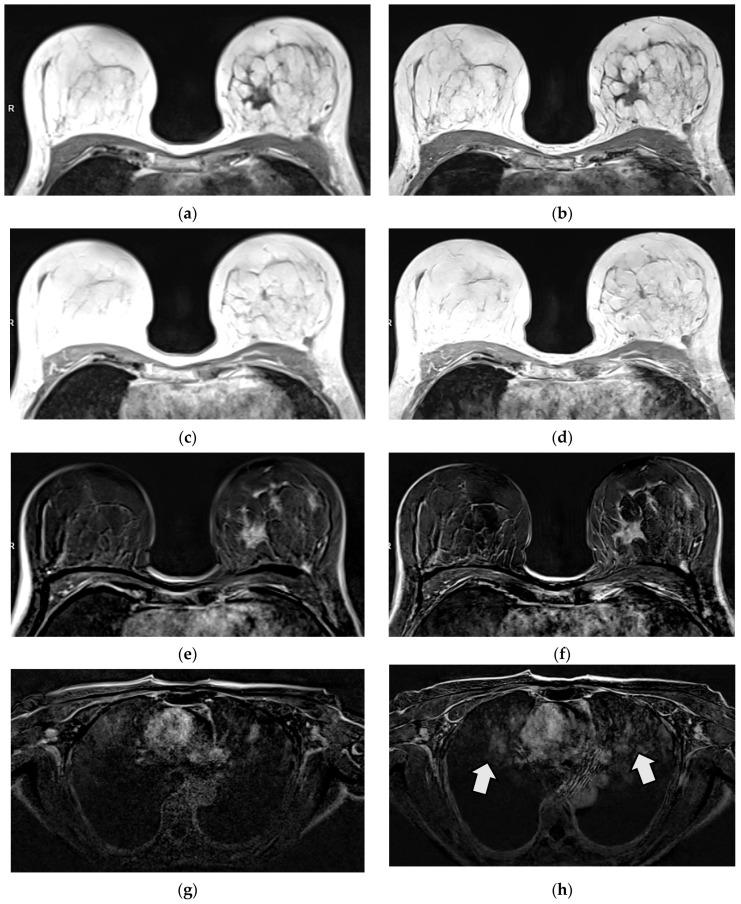 https://cdn.ncbi.nlm.nih.gov/pmc/blobs/3fe1/12248570/4992b0ad6e0b/diagnostics-15-01681-g004.jpg
