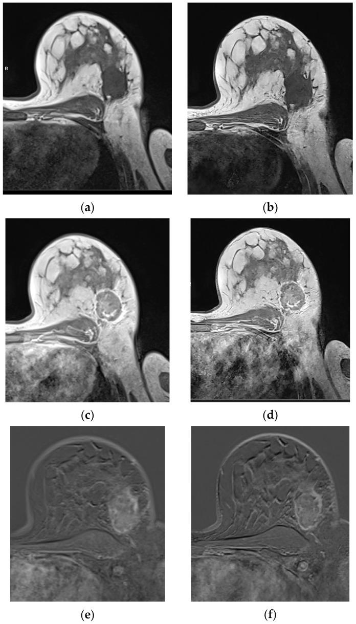 https://cdn.ncbi.nlm.nih.gov/pmc/blobs/3fe1/12248570/749753f25b63/diagnostics-15-01681-g003.jpg